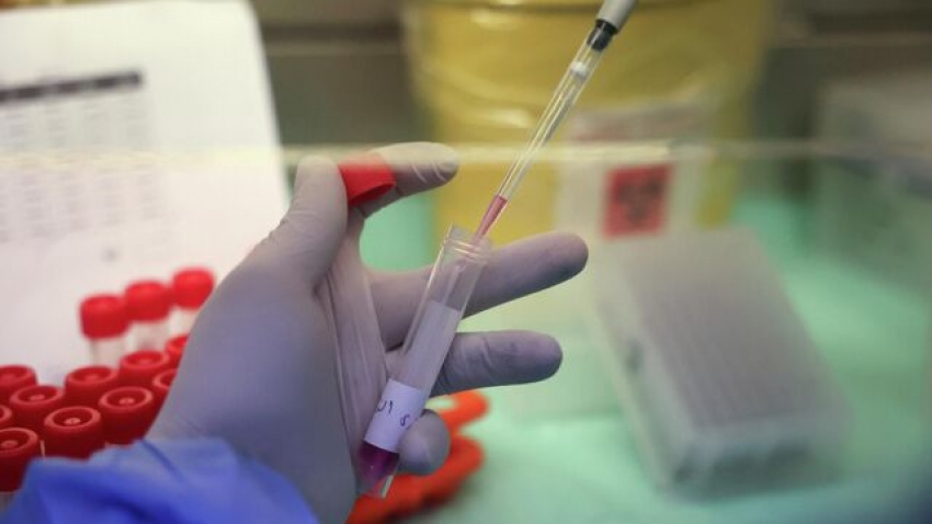 Более 20 случаев коронавируса выявили в Абхазии с 15 июля