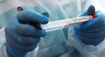 Три новых случая коронавируса зафиксированы в Абхазии